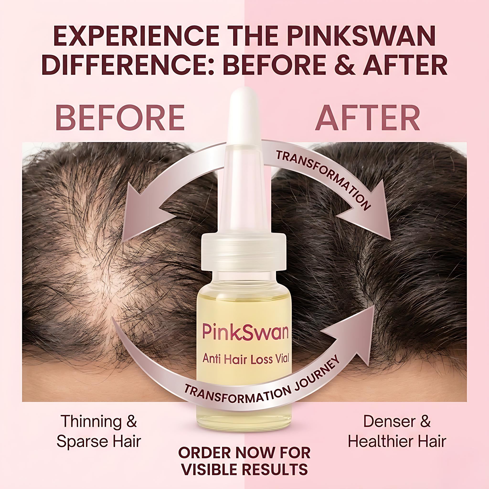 PINKSWAN ANTI-HAIR LOSS AMPOULES  5 Ampoules × 10 mL / pack